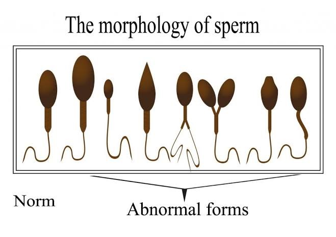 Normal Sperm Morphology