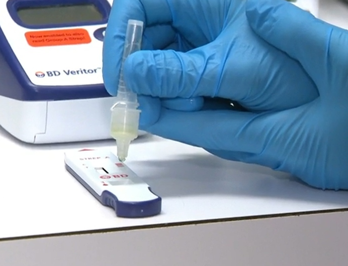 Strep test does a strep test for the flu 