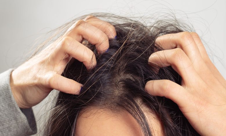 Get Rid Of Dead Skin Cells From The Scalp