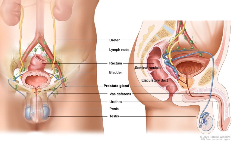 Hydrocele treatment