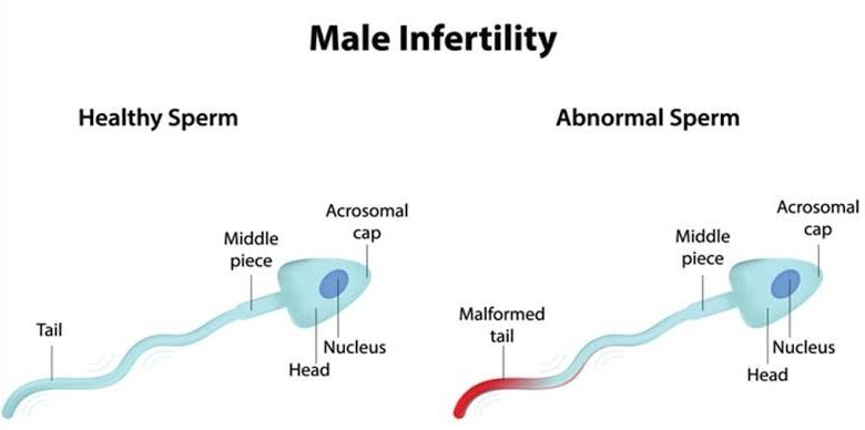 Sperm Fertility Test