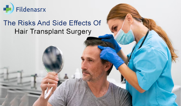 The Risks And Side Effects Of Hair Transplant Surgery